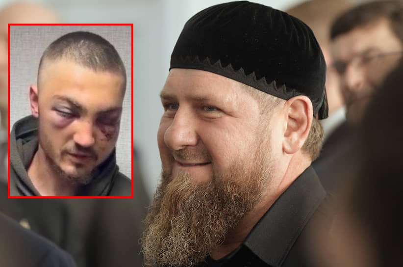Krimineli mesjetar Kadyrov masakron ushtarin ukrainas dhe e përqesh: Shkeli mbi një grabujë