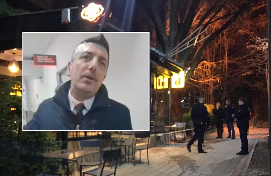 Pas arrestimit publikohen emrat e tre personave që e sulmuan Valon Sylën